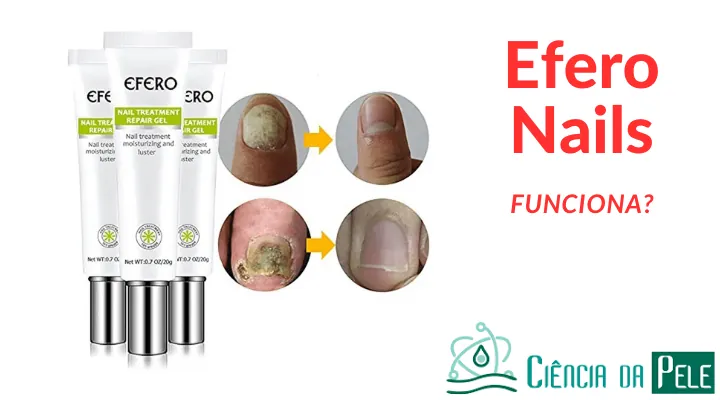 Efero Nails funciona? Descubra se é realmente eficaz