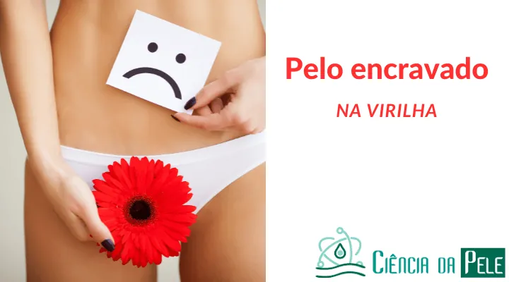Pelo Encravado na Virilha: Saiba tudo e como evitar