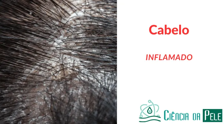 Cabelo Inflamado: Cuidados Específicos e Tratamentos