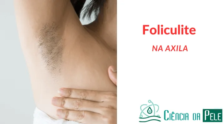 Foliculite na Axila: Identificação e Diagnóstico