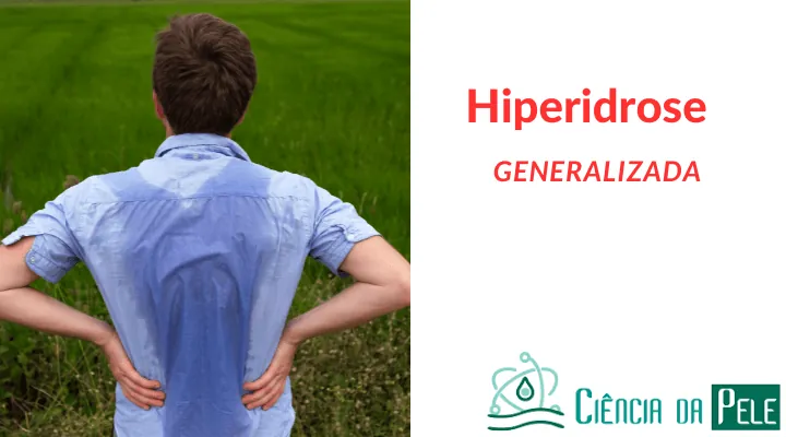 Hiperidrose Generalizada: Soluções Eficazes