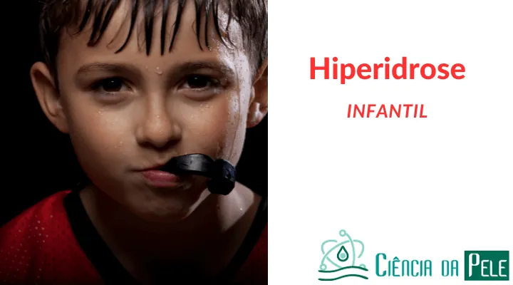 Hiperidrose infantil: O que Causa e como Tratar