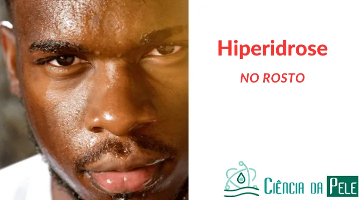 Hiperidrose no rosto: Causas, sintomas e tratamentos