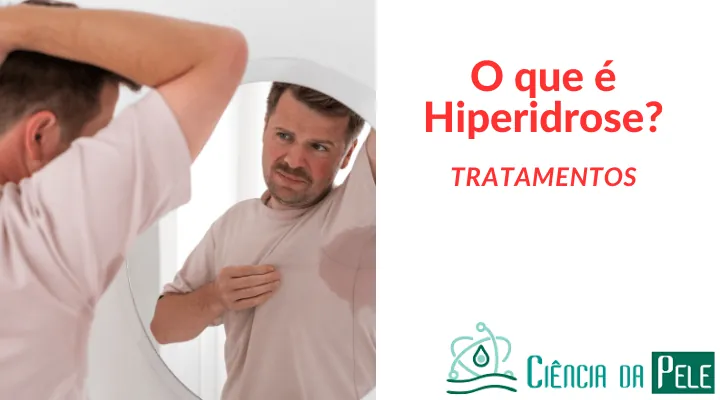 O que é hiperidrose: sintomas e tratamentos