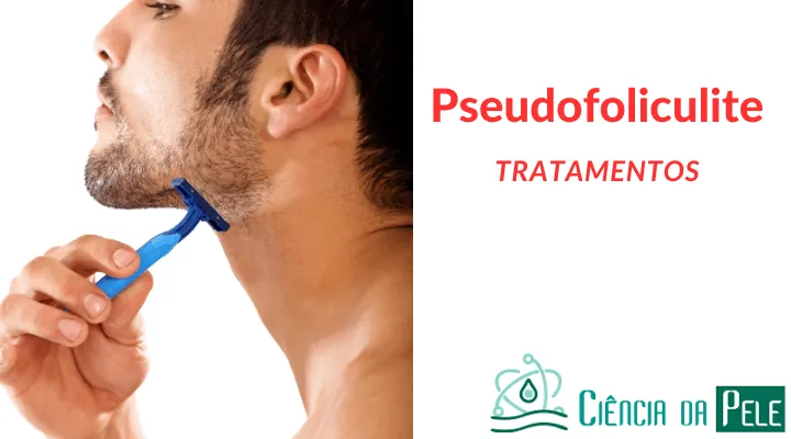 Pseudofoliculite: Causas, Sintomas e Tratamentos Eficazes