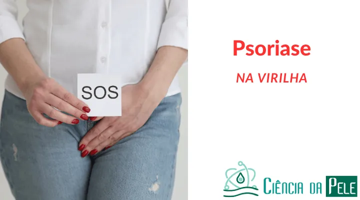 Psoríase na Virilha: Causas, Sintomas e Tratamentos Eficazes