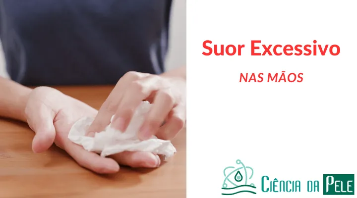 Suor Excessivo nas mãos: Causas e Tratamentos