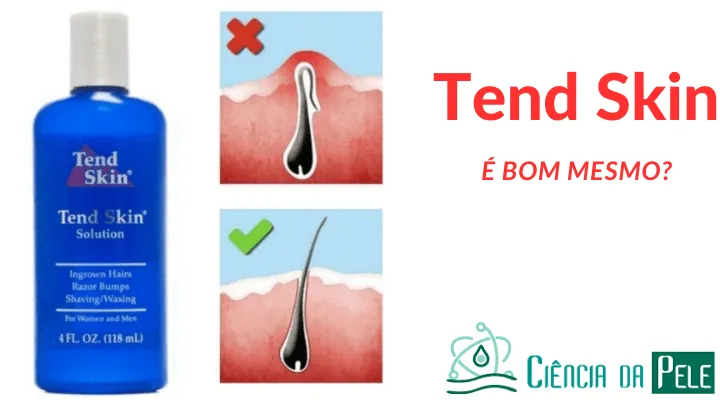 Tend Skin vs Bio Soft vs Labotrat vs Principia: Qual o Melhor Produto para Foliculite e Pelos Encravados?