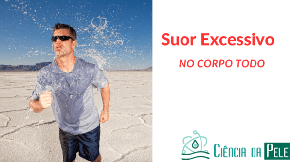 Suor Excessivo no corpo todo: Sintomas e Tratamentos - Ciência da Pele