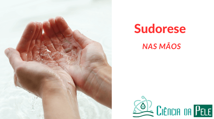 Sudorese nas mãos: Tratamentos não Cirúrgicos