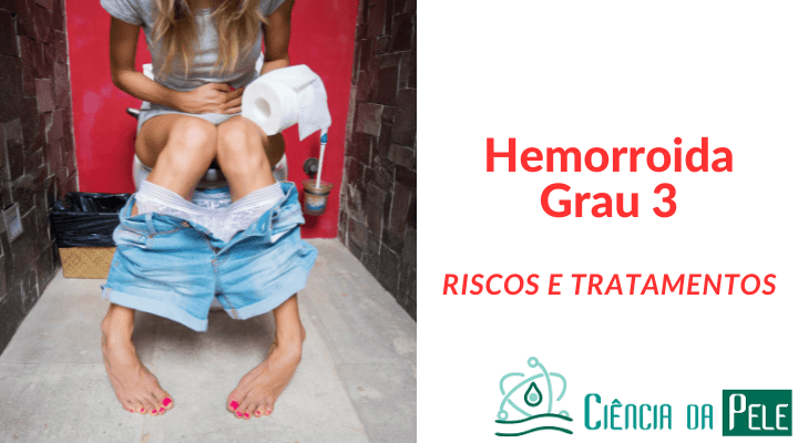 hemorroida grau 3
